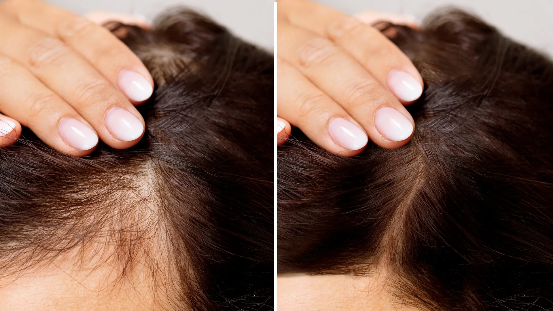 10 cách trị rụng tóc tại nhà cực dễ làm, ai đang sợ hói đầu đừng bỏ qua