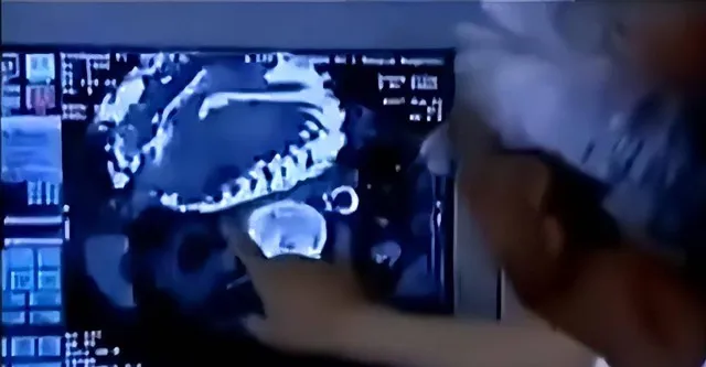 cu-ba-91-tuoi-bi-nga-di-kham-phat-hien-co-thai-2