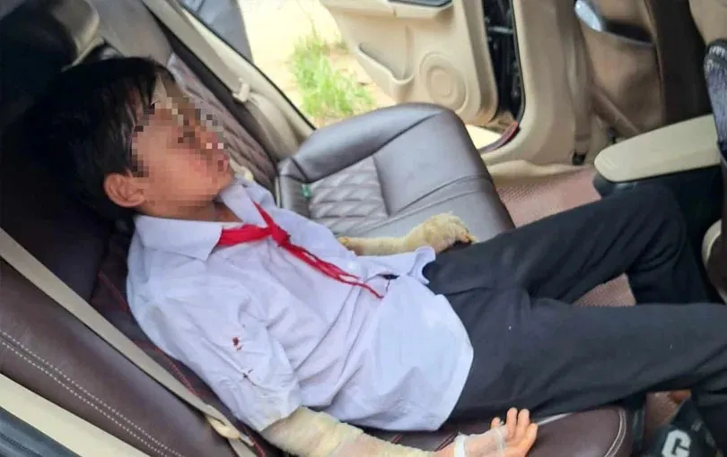 nguyen-nhan-bong-bay-phat-no-trong-ngay-le-khai-giang-khien-nhieu-hoc-sinh-bi-thuong-1