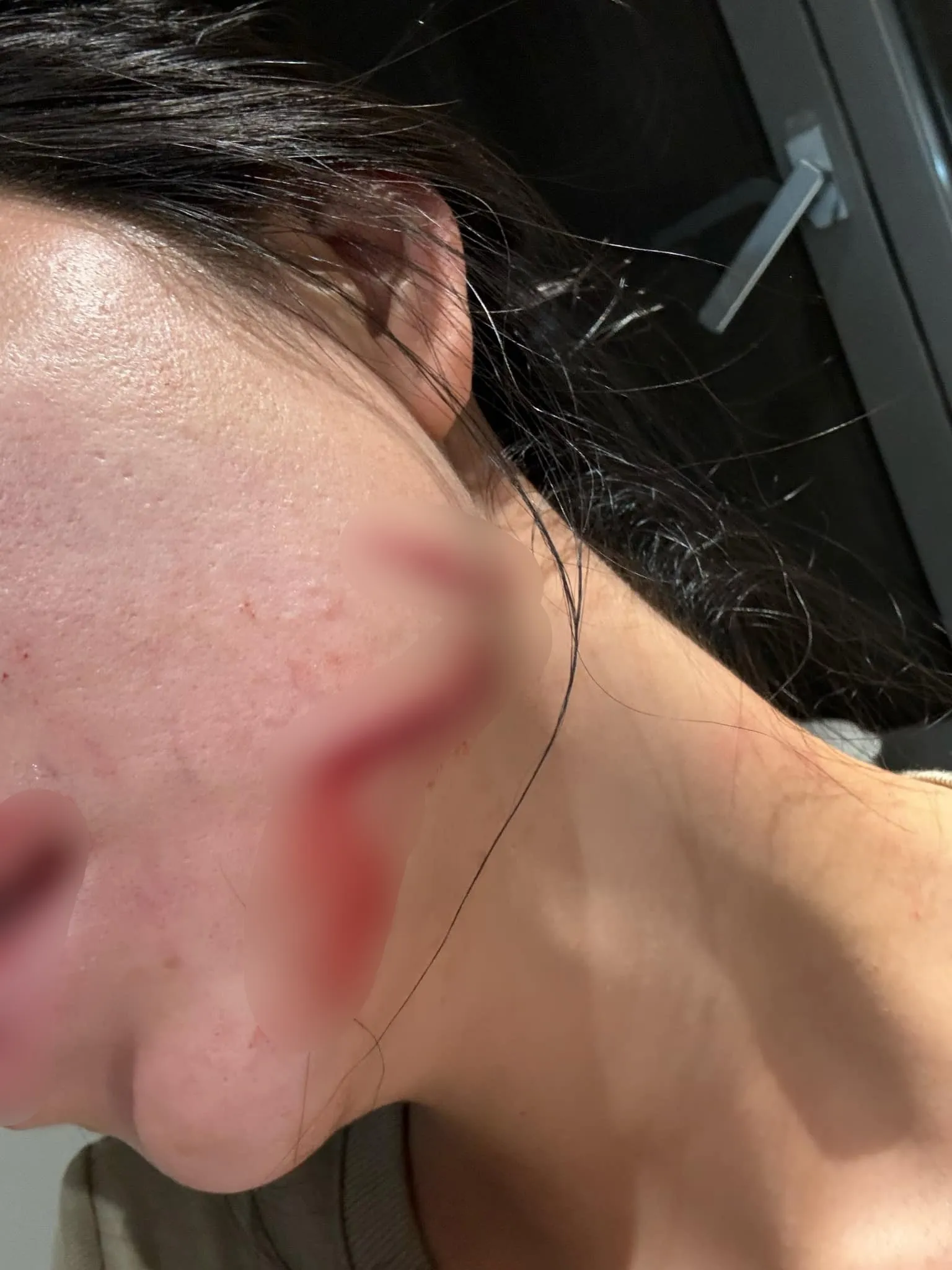 hang-du-muc-dang-tai-loat-hinh-anh-bi-chong-tac-dong-vat-ly-3