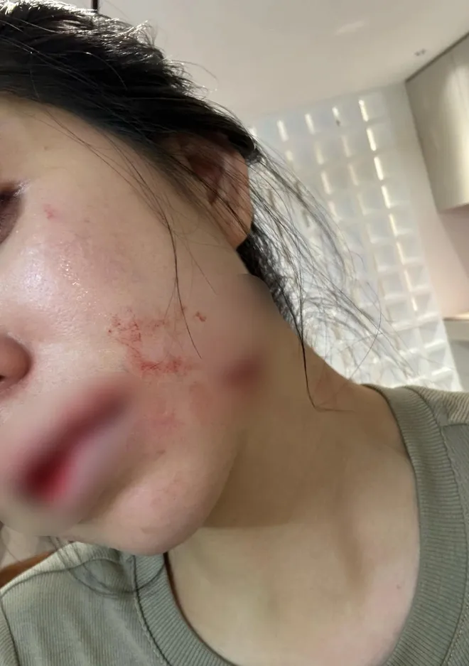 chong-hang-du-muc-duoc-tai-ngoai-sau-2-ngay-tam-giam-2