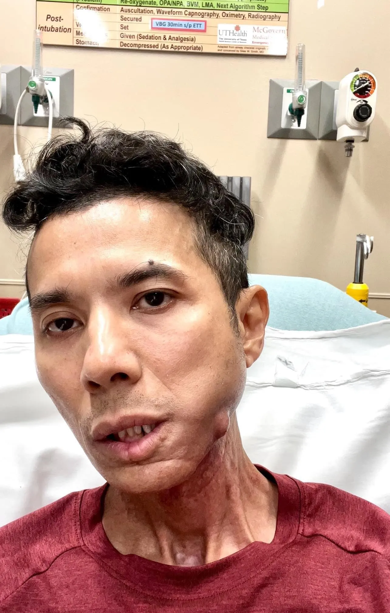 ca-si-kasim-hoang-vu-len-tieng-noi-ro-tinh-trang-suc-khoe-hien-tai-1