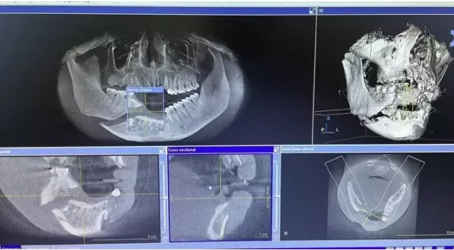nam-thanh-nien-mat-toan-bo-rang-cua-vi-cui-nguoi-vao-thang-may-de-nhat-dien-thoai-1