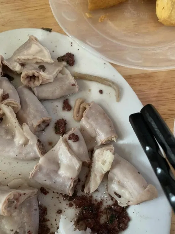 di-an-bun-dau-mam-tom-co-gai-phat-hien-giun-san-trong-long-lon (2)