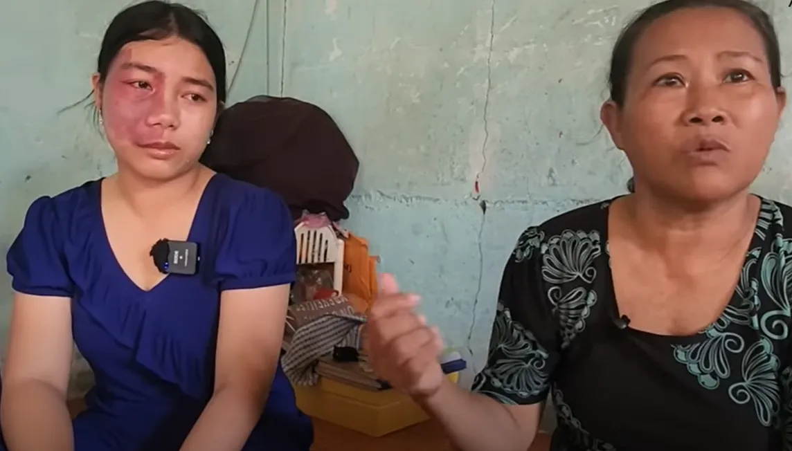 ngam-ngui-co-gai-22-tuoi-co-guong-mat-quy (3)