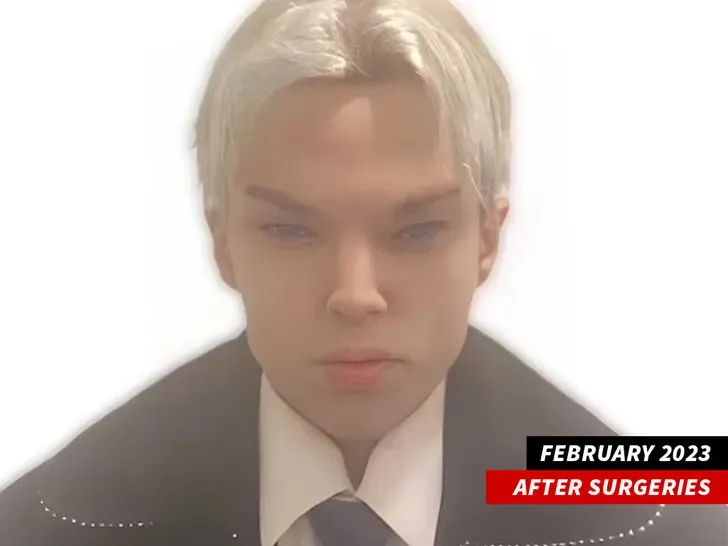 nam-dien-vien-qua-doi-sau-12-lan-phau-thuat-giong-jimin-bts (3)