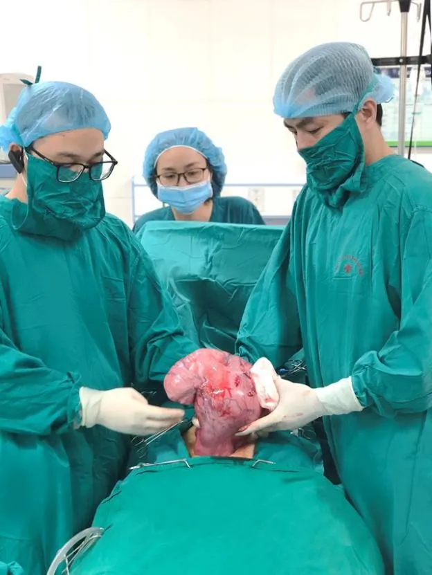 3-thang-bung-to-bat-thung-nhung-khong-met-moi-nguoi-phu-nu-di-kham-phat-hien-chuyen-khong-ngo (1)