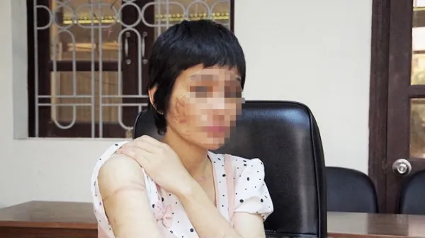 vu-thai-phu-7-thang-bi-chong-tac-dong-vat-ly (3)