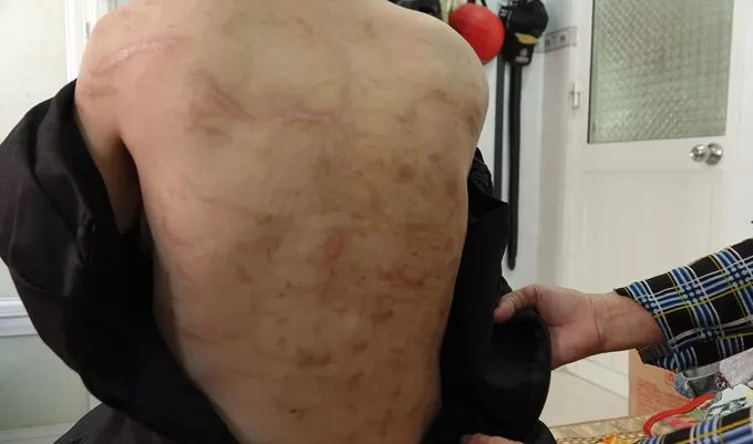 vu-thai-phu-7-thang-bi-chong-tac-dong-vat-ly (6)