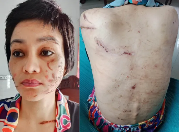 vu-thai-phu-7-thang-bi-chong-tac-dong-vat-ly (98)