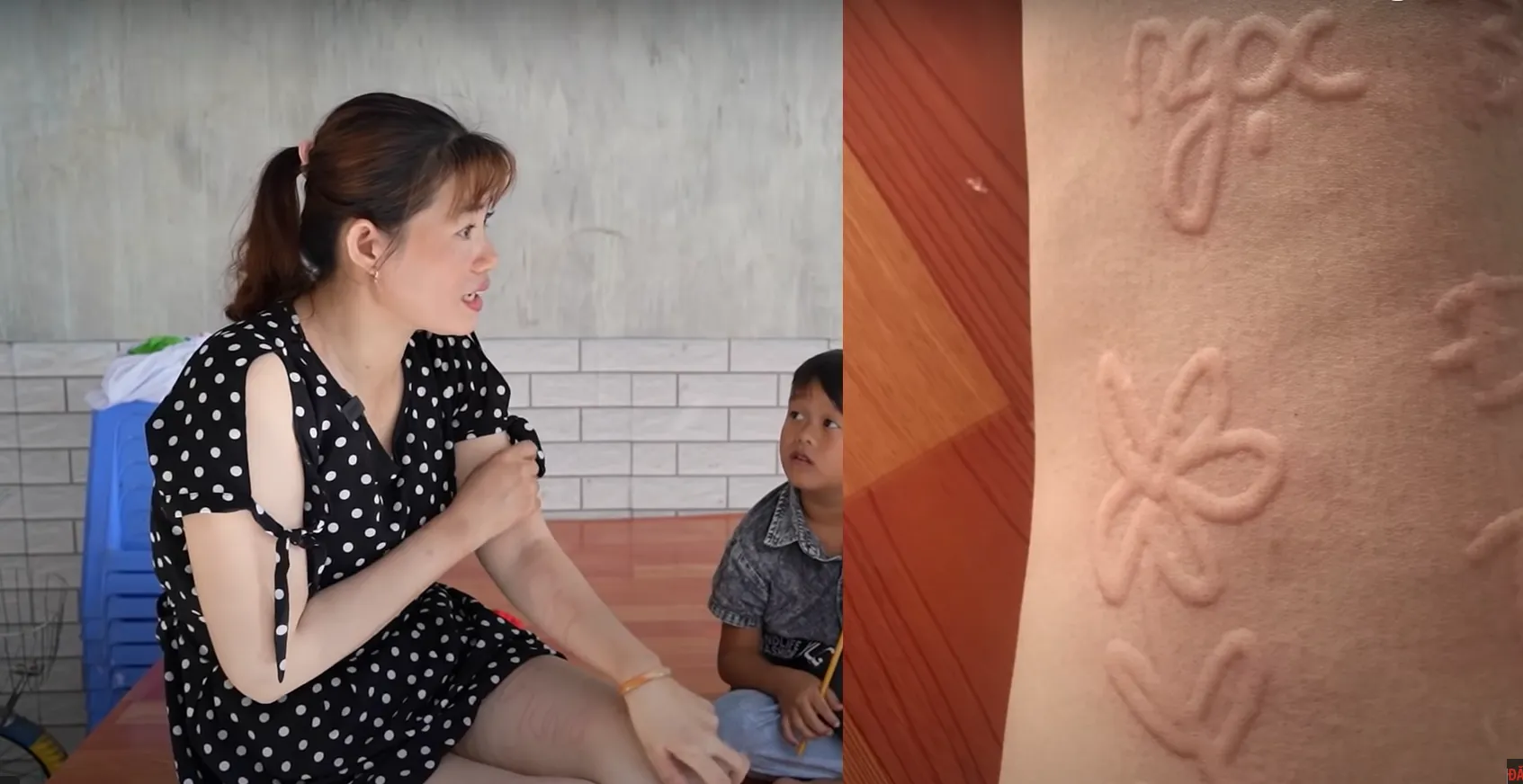 hai-nguoi-phu-nu-so-huu-lan-da-ky-la-co-the-viet-chu-ve-tranh-noi-len-nhu-3d (3)