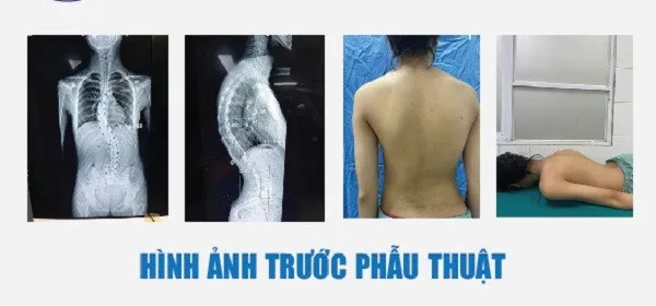 ngoi-hoc-sai-tu-the-nhieu-nam-bu-sinh-bi-cong-veo-cot-song-phai-bat-22-chiec-vit-de-nan-lai (4)