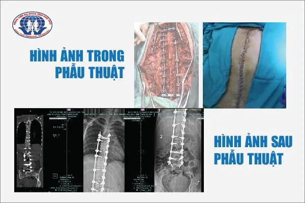 ngoi-hoc-sai-tu-the-nhieu-nam-bu-sinh-bi-cong-veo-cot-song-phai-bat-22-chiec-vit-de-nan-lai (41)