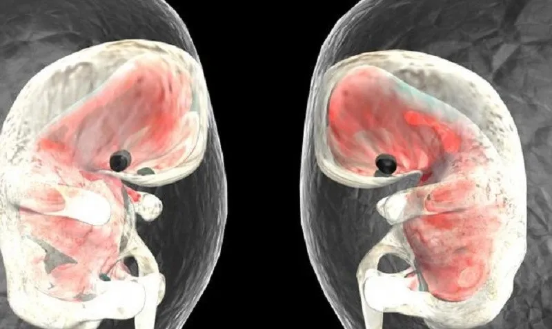 be-gai-7-thang-tuoi-lien-tuc-gao-khoc-di-kham-phat-hien-bao-thai-7kg-trong-da-day-khien-gia-dinh-choang-vang (12)