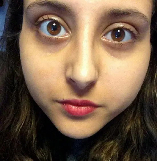 4-tin-hieu-xuat-hien-canh-bao-nguy-co-mac-ung-thu-nhieu-nguoi-khong-de-y-phat-hien-som-keo-muon (7)