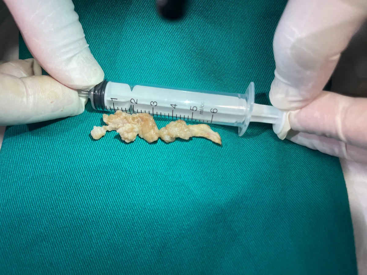 an-com-voi-cha-la-lot-nguoi-dan-ong-suyt-ra-di-mai-mai-bac-si-noi-nguyen-nhan-ai-nghe-xong-cung-ren (113)