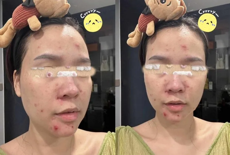 vua-cong-bo-mang-thai-sam-de-lo-suc-khoe-dang-lo-tiet-lo-khong-dam-ra-duong (4)