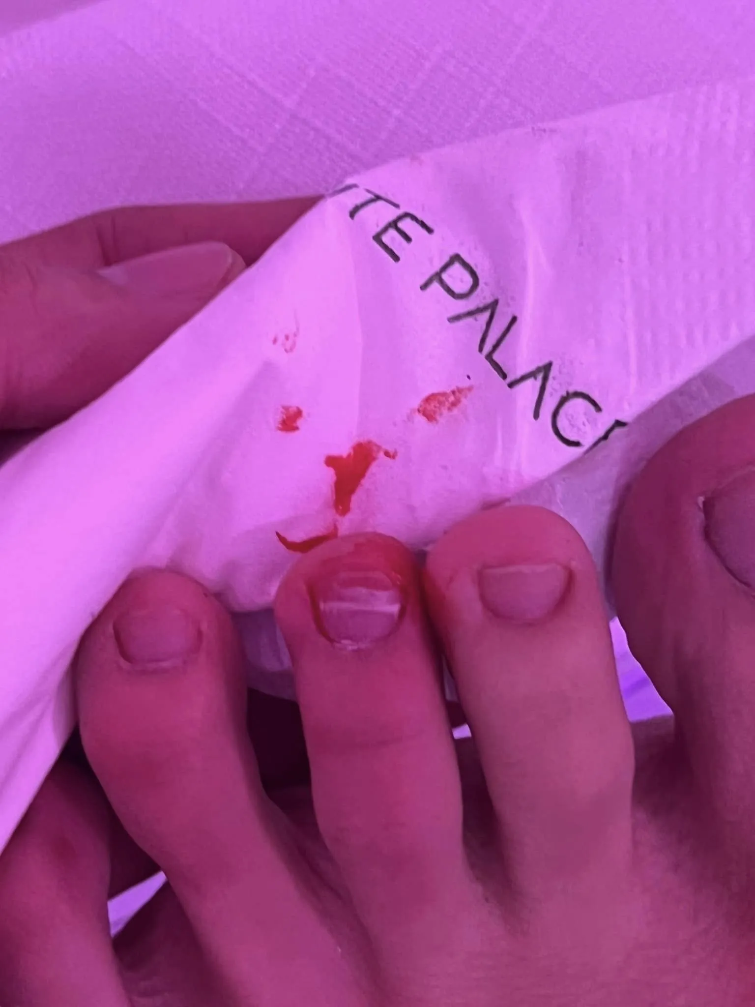 mot-sao-nu-gap-su-co-do-mau-trong-tiec-cuoi-cua-puka-gin-tuan-kiet-gio-di-lai-kho-khan (2)