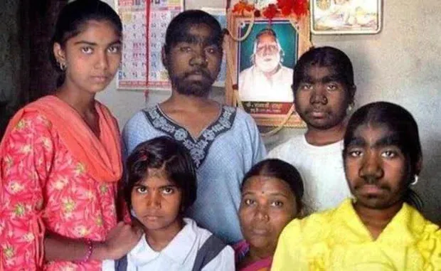 doc-la-ngoi-lang-co-hon-200-nguoi-giong-nhau-y-duc-tu-nam-den-nu-cach-phan-biet-cung-co-1-0-2 (113)