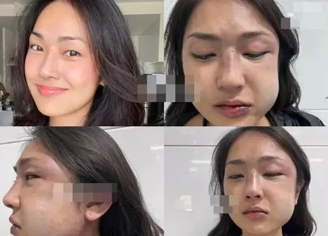 nu-mc-quen-mat-showbiz-viet-tung-to-ban-trai-tac-dong-vat-ly-tram-trong-tinh-trang-hien-tai-hau-bien-co-ra-sao (3)