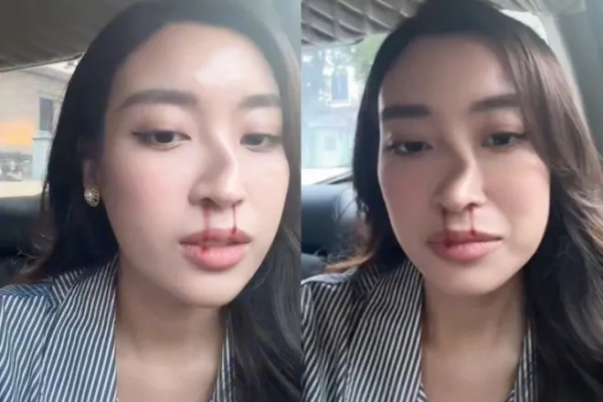 hoa-hau-viet-nam-tung-dang-clip-bi-tac-dong-vat-ly-den-muc-khong-ai-nhan-ra-gio-lay-chong-thieu-gia-tai-san-nghin-ty (2)