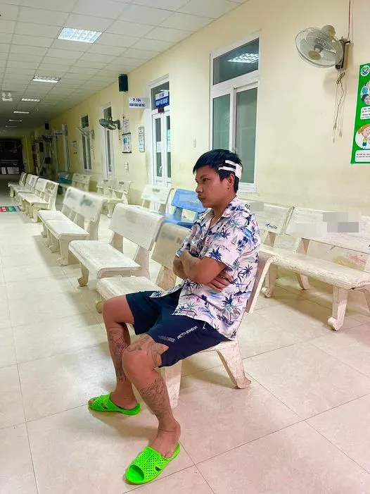 loc-fu-ho-bi-chan-thuong-dau-dip-can-tep-dan-tinh-xon-xao-vi-bi-vo-tac-dong-vat-ly (4)