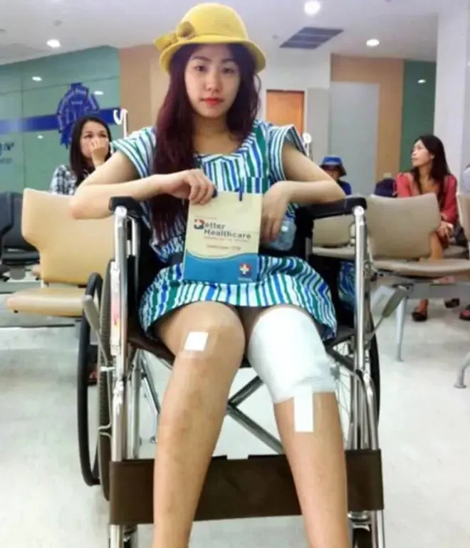 luong-bich-huu-gap-su-co-bong-mat-phai-hup-chao-trang-tam-ly-anh-huong-phai-o-an-nhieu-nam (2)