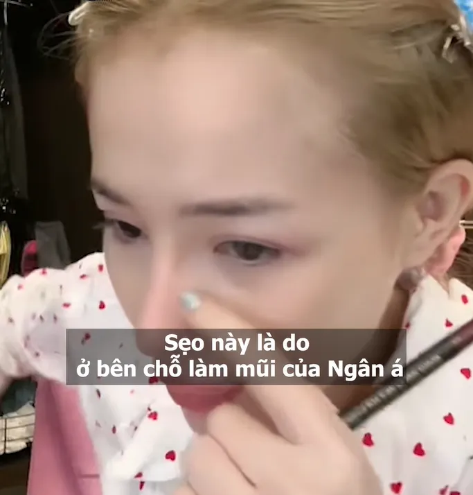 ngan-98-bien-chung-hau-trung-tu (3)