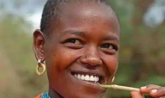 vi-sao-nguoi-chau-phi-rang-trang-du-it-dung-kem-danh-rang (3)