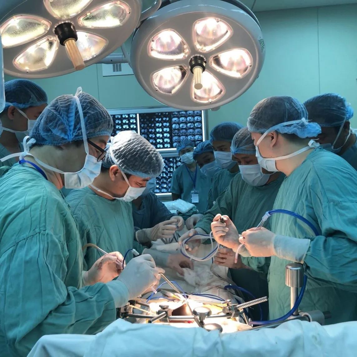 su-that-truyen-mau-ghep-tang-lam-thay-doi-tinh-cach (113)