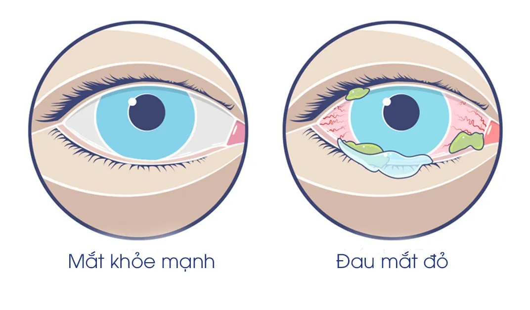 mot-can-benh-de-lay-lan-trong-mua-he-can-chu-y-de-bao-ve-suc-khoe-2