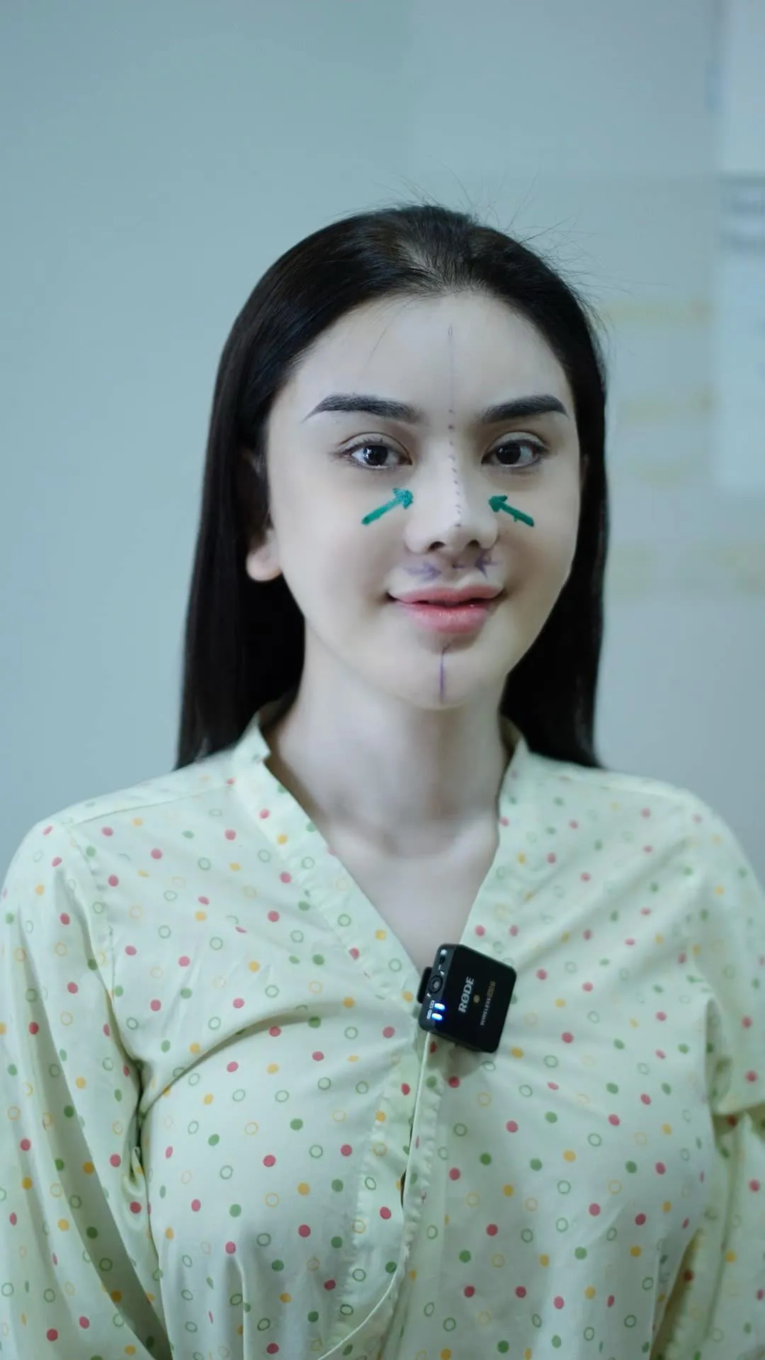 lam-khanh-chi-phau-thuat-tham-my-3