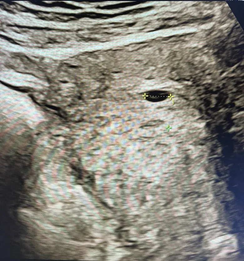 vai-tuan-nua-to-chuc-dam-cuoi-cho-con-trai-di-kham-ba-noi-tuong-lai-do-khoc-do-cuoi-khi-biet-da-co-b-348689387_927477311877546_6110262612861861817_n-1686645409-380-width780height833