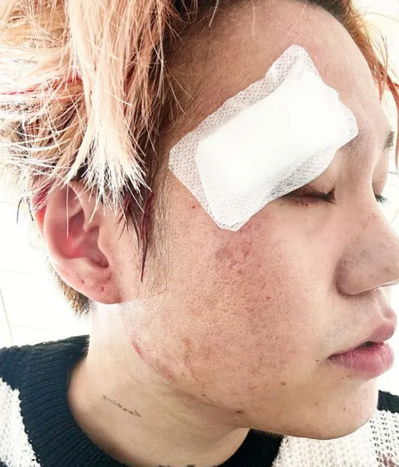 nam-ca-si-28-tuoi-bi-co-giat-phai-nhap-vien-cap-cuu (1)