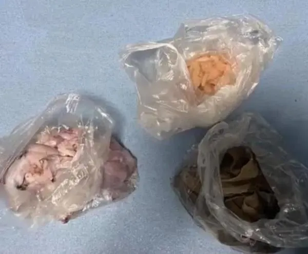 hai-co-gai-di-an-bufet (1)