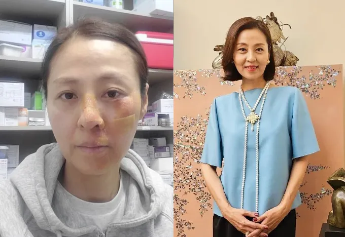 jeon-hye-jin-bi-thuong-nhan-sac-anh-huong-nang (8)