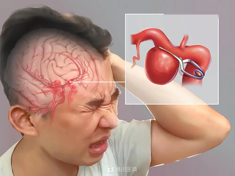 o-gai-24-tuoi-bi-dot-quy (2)