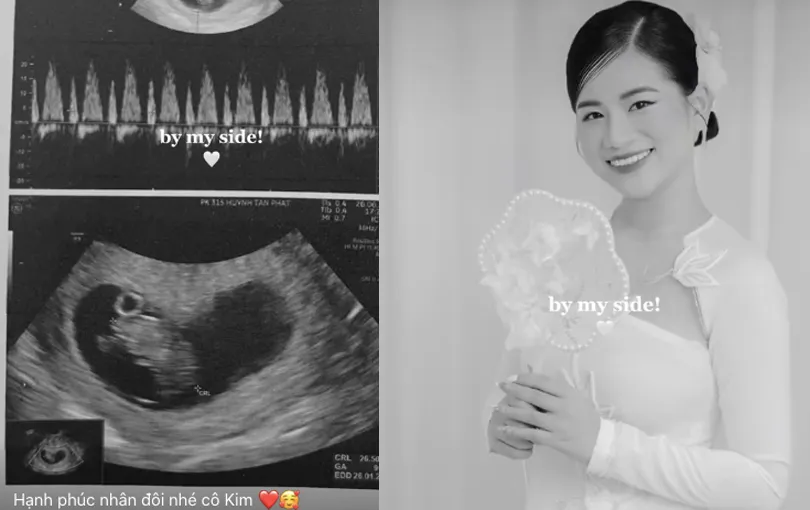 bao-mau-cua-doan-di-bang-3