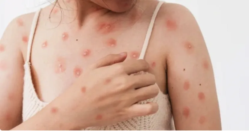 tphcm-ghi-nhan-ca-mac-dau-mua-khi-1