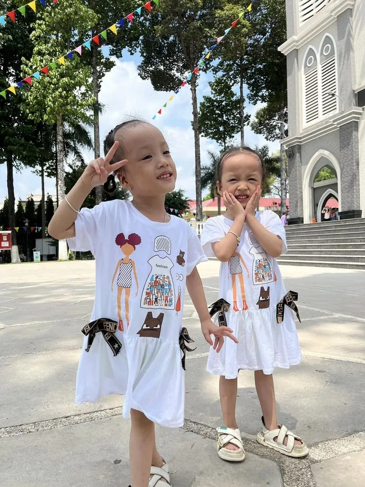 cap-song-sinh-dinh-lien-duoc-tach-roi-sau-hon-3-nam-hien-ra-sao-3