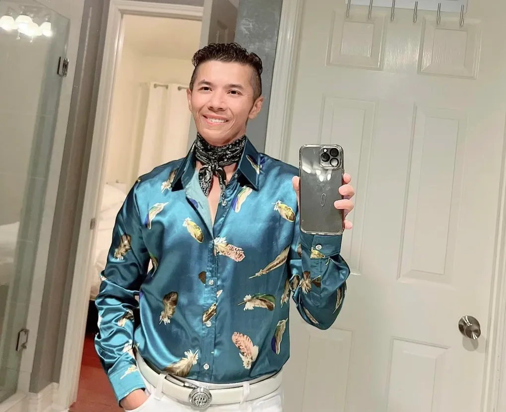 kasim-hoang-vu-an-chao-loang-nhieu-thang-sau-khi-phau-thua-xuong-ham-4