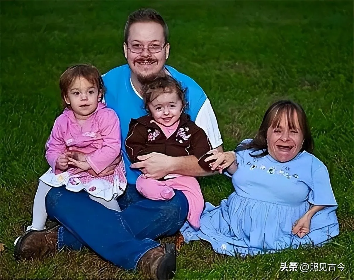 nguoi-phu-nu-cao-70cm-lay-chong-cao-1m8-sinh-duoc-3-con-1