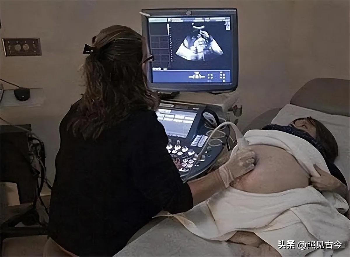 nguoi-phu-nu-cao-70cm-lay-chong-cao-1m8-sinh-duoc-3-con-2