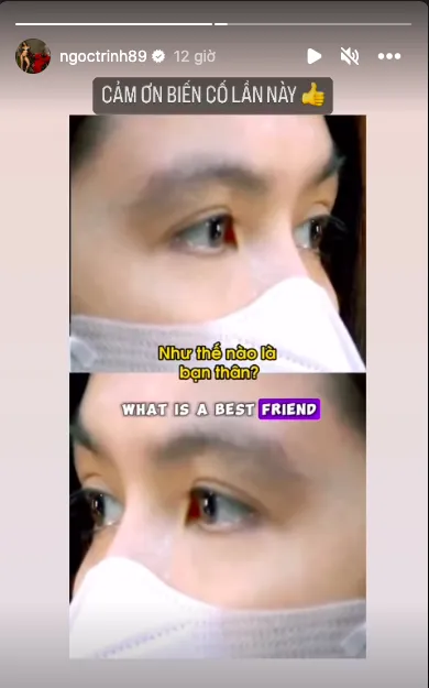 ngoc-trinh-sau-khi-vuong-vong-lao-ly