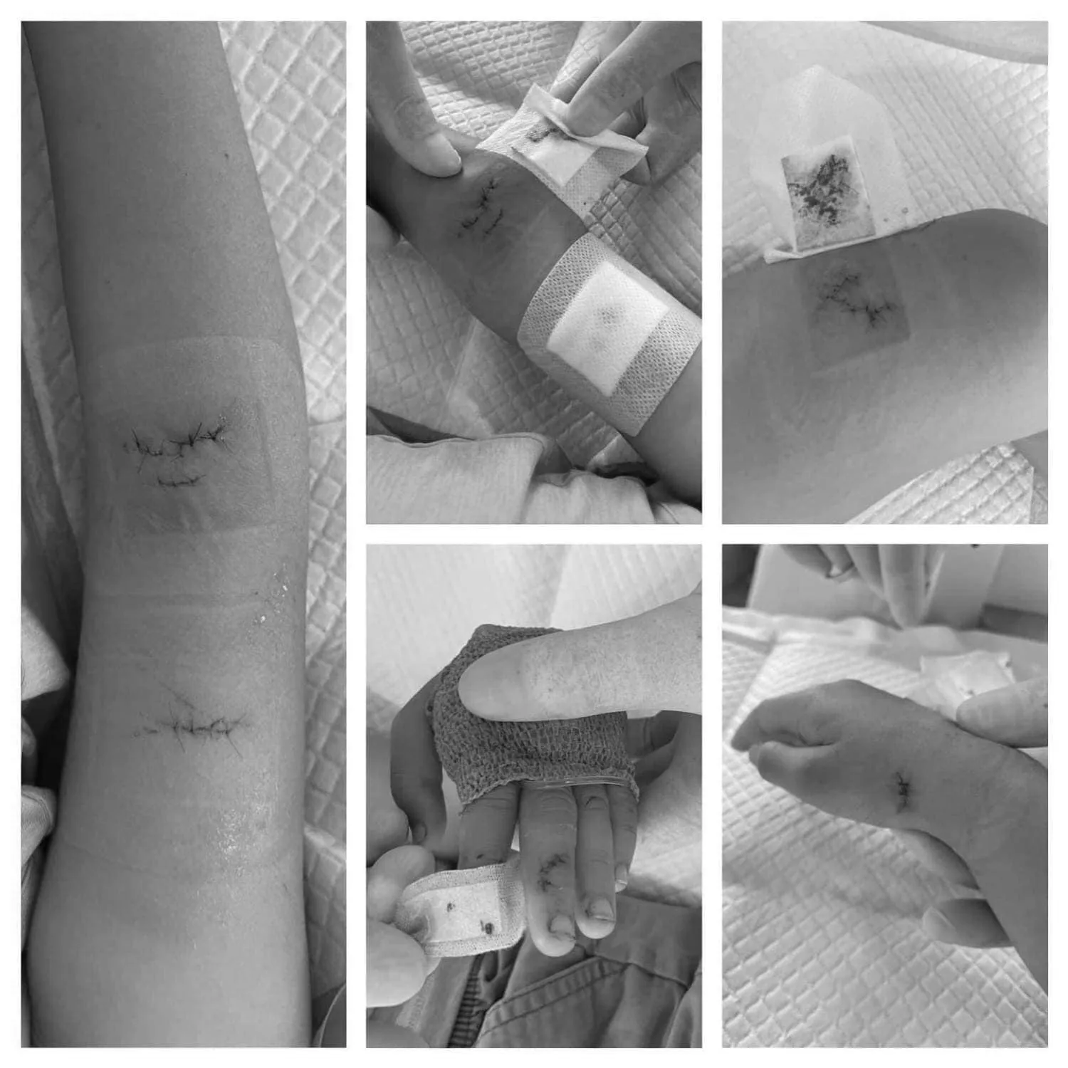 3-me-con-nhap-vien-vi-vo-kinh-cuong-luc-trong-nha-tam-1