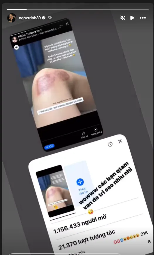 hon-1-trieu-nguoi-xem-ngoc-trinh-tri-seo-o-chan