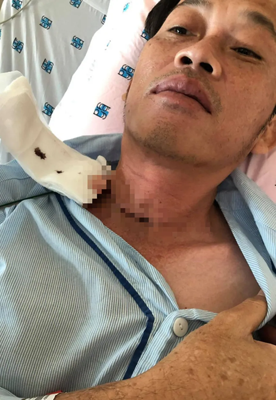 hoai-linh-ra-sao-sau-4-nam-bi-ung-thu-3