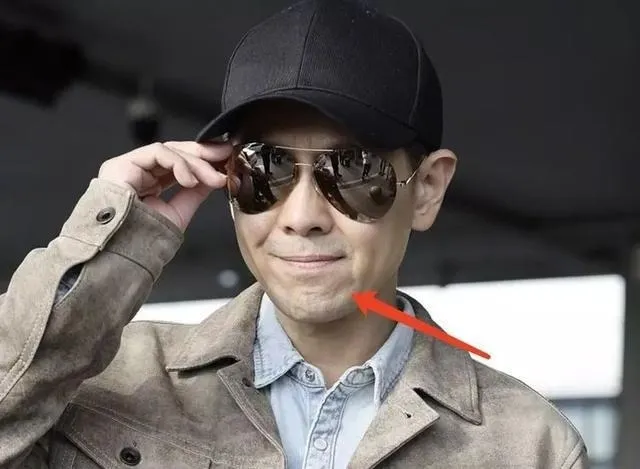 yeah1-lam-chi-dinh-khac-la-sau-tai-nan (1)