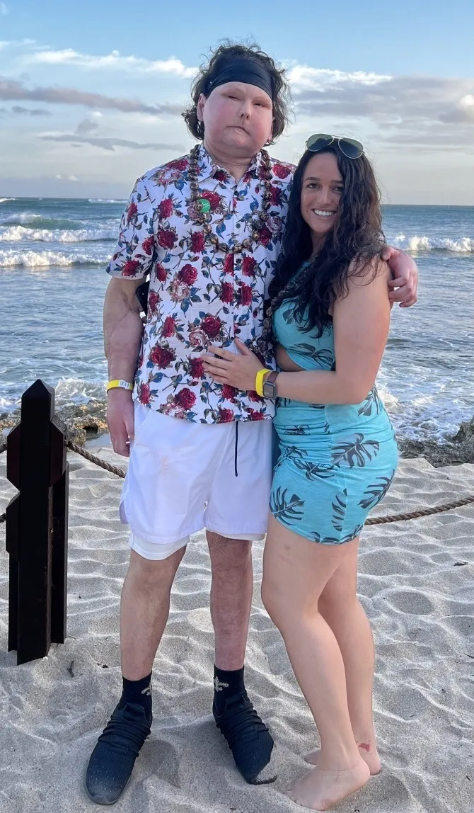 yeah1-nguoi-phau-thuat-ghep-mat-dau-tien-tren-the-gioi (2)