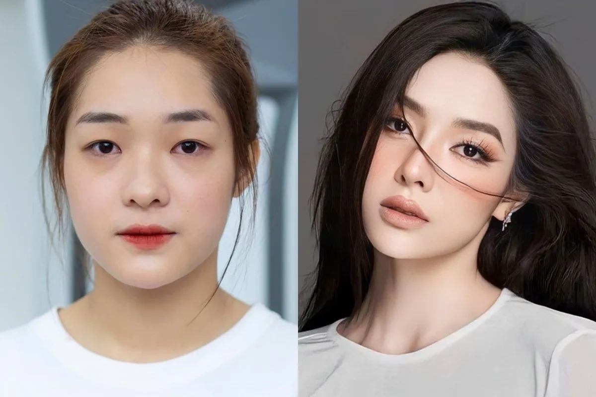 yeah1-nhan-sac-truoc-phau-thuat-tham-my-a-hau-3-miss-grand-vietnam (6)